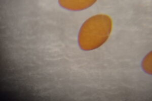 アキアカネの卵