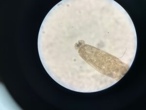 顕微鏡で覗いた寄生虫