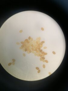 顕微鏡でのぞいたトンボの卵