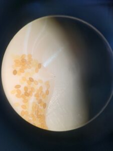 アキアカネの卵