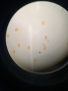 マユタテアカネの卵